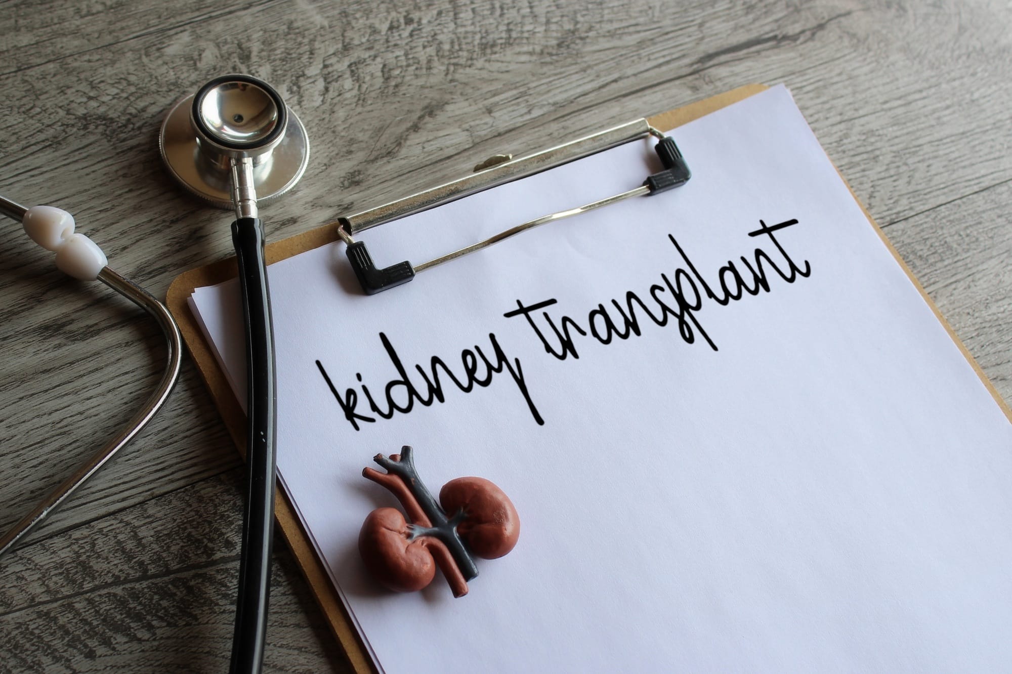 Kidney model, stethoscope and paper clipboard with text KIDNEY TRANSPLANT