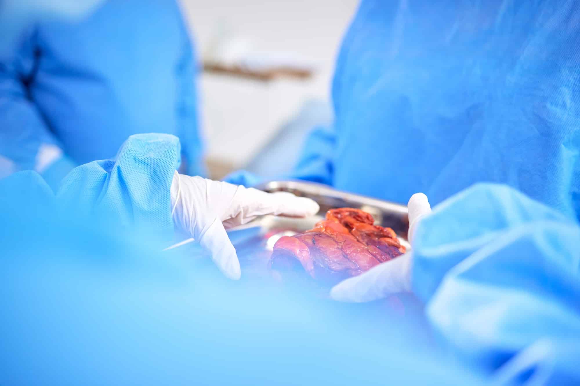 Organ transplant, hands and doctor surgery, medical support or teamwork on liver, healing accident