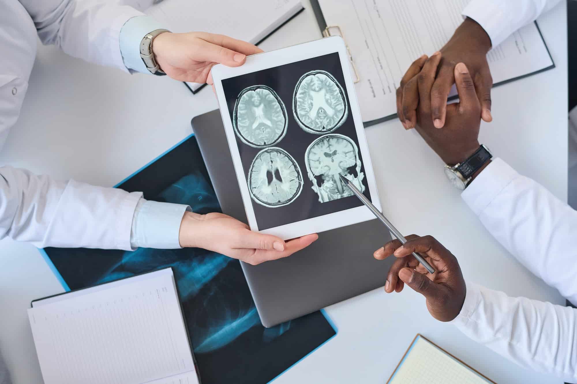 Doctors examining brain tomography image in team